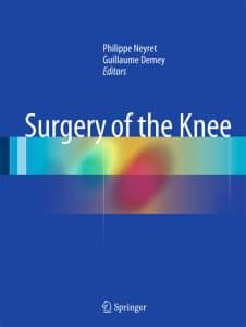 surgery_of_the_knee